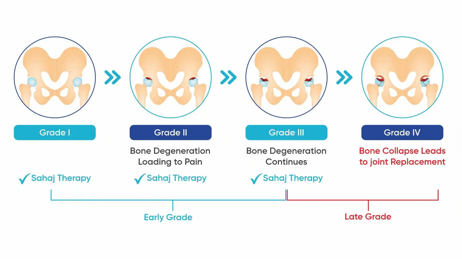 AVN Healing stages