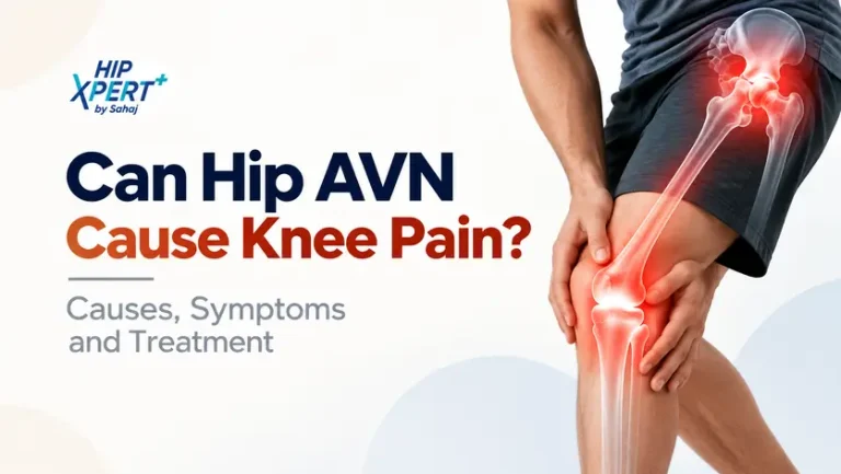 Can Hip AVN Cause Knee Pain? Symptoms & Treatment