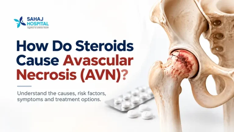 How do steroids cause avascular necrosis (AVN)? Medical illustration of hip bone damage with steroid tablets