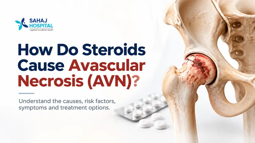 How do steroids cause avascular necrosis (AVN)? Medical illustration of hip bone damage with steroid tablets